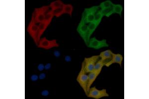EPB41L3 Mouse Monoclonal Antibody staining Hela cells by IF/ICC.