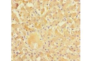 Immunohistochemistry of paraffin-embedded human liver tissue using ABIN7161898 at dilution of 1:100 (NR1I3 anticorps  (AA 2-351))