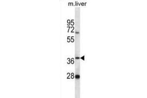 Western Blotting (WB) image for anti-Paroxysmal Nonkinesigenic Dyskinesia (PNKD) antibody (ABIN2996825)