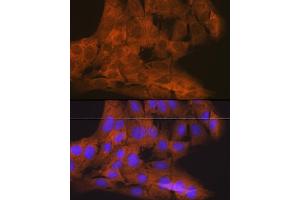 Immunofluorescence analysis of C6 cells using TBK1/NAK Rabbit mAb (ABIN7270723) at dilution of 1:100 (40x lens). (TBK1 anticorps)