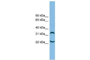 WB Suggested Anti-C6orf134 Antibody Titration: 0. (Chromosome 6 Open Reading Frame 134 (C6orf134) (N-Term) anticorps)