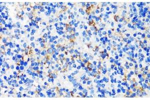 Immunohistochemistry of paraffin-embedded Mouse spleen using TSC2 Polyclonal Antibody at dilution of 1:200 (40x lens). (Tuberin anticorps)