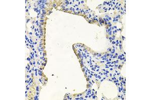 Immunohistochemistry of paraffin-embedded mouse lung using PKN1 antibody (ABIN6003498) at dilution of 1/100 (40x lens). (PKN1 anticorps)