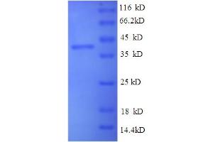 SDS-PAGE (SDS) image for Wingless-Type MMTV Integration Site Family Member 2 (WNT2) (AA 26-360) protein (His tag) (ABIN5713946)