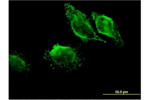Immunofluorescence of monoclonal antibody to MAPRE3 on HeLa cell. (MAPRE3 anticorps  (AA 125-218))