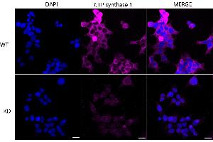 Immunocytochemical staining of 293T cells using CTP synthase 1 antibody (ABIN7798174), 1:1,000), Top panel: wild-type (WT), Bottom panal: CTP synthase 1 shRNA knockdown (KD). (Recombinant CTP Synthase anticorps)