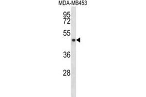 Western Blotting (WB) image for anti-Sirtuin 3 (SIRT3) antibody (ABIN2998084) (SIRT3 anticorps)