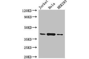 Western Blot Positive WB detected in: Jurkat whole cell lysate, Hela whole cell lysate, HEK293 whole cell lysate All lanes: HLA-C antibody at 4 μg/mL Secondary Goat polyclonal to rabbit IgG at 1/50000 dilution Predicted band size: 41 kDa Observed band size: 41 kDa (HLA-C anticorps  (AA 25-308))