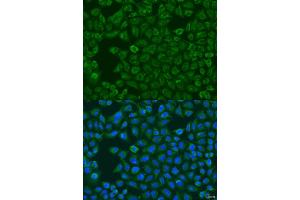 Immunofluorescence analysis of U2OS cells using FMO5 antibody (ABIN2736763) at dilution of 1:100.