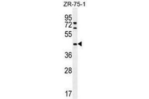 METTL2 anticorps  (C-Term)