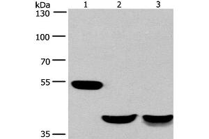 Western Blot analysis of Mouse brain and Human fetal muscle tissue, Mouse heart tissue using CABLES1 Polyclonal Antibody at dilution of 1:650
