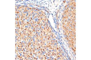 Immunohistochemistry of paraffin-embedded rat ovary using G1 Rabbit mAb (ABIN7265446) at dilution of 1:100 (40x lens). (gamma 1 Adaptin anticorps)