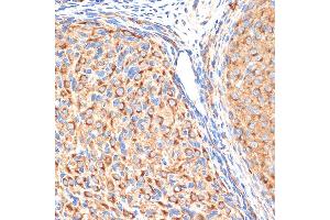 Immunohistochemistry of paraffin-embedded rat ovary using G1 Rabbit mAb (ABIN7265446) at dilution of 1:100 (40x lens).
