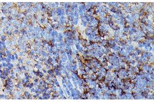 Immunohistochemistry of paraffin-embedded Rat spleen using HLA-B Polyclonal Antibody at dilution of 1:100 (40x lens).