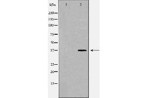 Western blot analysis of extracts of K562, using POLB antibody. (POLB anticorps  (C-Term))