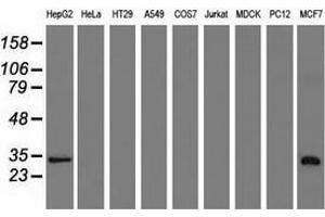 Western blot analysis of extracts (35 µg) from 9 different cell lines by using anti-SULT2A1 monoclonal antibody.