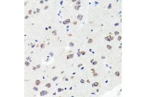 Immunohistochemistry of paraffin-embedded mouse brain using DLG1 antibody at dilution of 1:100 (x40 lens). (DLG1 anticorps)