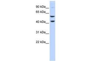 Image no. 1 for anti-ATPase, H+ Transporting, Lysosomal 56/58kDa, V1 Subunit B2 (ATP6V1B2) (C-Term) antibody (ABIN6744046)