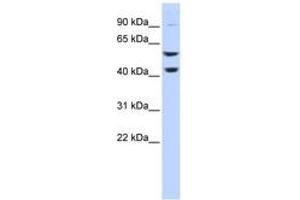 Image no. 1 for anti-ATPase, H+ Transporting, Lysosomal 56/58kDa, V1 Subunit B2 (ATP6V1B2) (C-Term) antibody (ABIN6744046) (ATP6V1B2 anticorps  (C-Term))