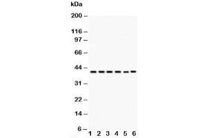 Western blot testing of CXCR2 antibody and Lane 1:  rat spleen;  2: rat kidney;  3: rat brain;  4: mouse testis;  5: HEPA;  6: mouse brainat 50ug;  Predicted size: 41KD;  Observed size: 41KD