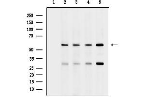 Western blot analysis of lysates from various samples, using Phospho-beta Catenin (Ser33) Antibody.