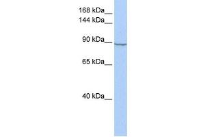 Western Blotting (WB) image for anti-Hexokinase 2 (HK2) antibody (ABIN2459729) (Hexokinase 2 anticorps)