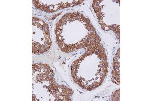 Immunohistochemical analysis of A on paraffin-embedded Human testis tissue.