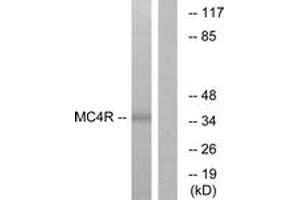 Western blot analysis of extracts from MCF-7 cells, using MC4R Antibody. (MC4R anticorps  (AA 281-330))