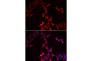 Immunofluorescence analysis of U2OS cell using PCBD1 antibody. (PCBD1 anticorps)