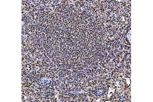 IHC analysis of hnRNP L/HNRNPL using anti-hnRNP L/HNRNPL antibody (ABIN7600130). (HNRNPL anticorps  (AA 152-569))