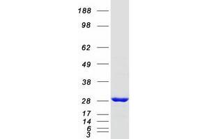 Validation with Western Blot