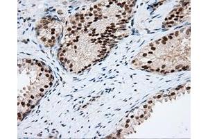 Immunohistochemical staining of paraffin-embedded Kidney tissue using anti-RC201933 mouse monoclonal antibody. (PIM2 anticorps)