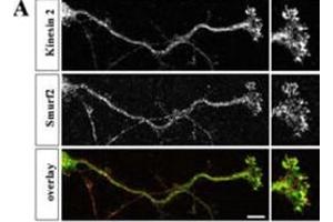Hippocampal neurons were fixed at stage 3, stained with anti-Smurf2 (red) and anti-Kinesin-2 (green) antibodies, and analyzed by confocal microscopy.