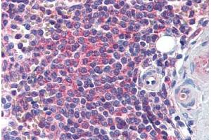 anti-Enhancer of mRNA Decapping 4 (EDC4) (AA 1302-1402) antibody