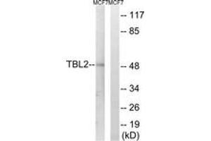 Western blot analysis of extracts from MCF-7 cells, using TBL2 Antibody. (TBL2 anticorps  (AA 381-430))