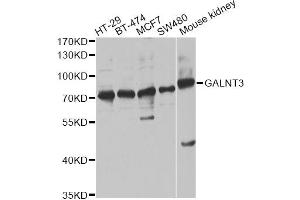 Western blot analysis of extracts of various cell lines, using GALNT3 antibody (ABIN6292787) at 1:1000 dilution. (GALNT3 anticorps)