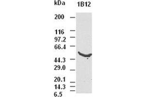 CK8 antibody (1B12) at 1:5000 dilution + Hela cell lysate (KRT8 anticorps  (AA 91-381))