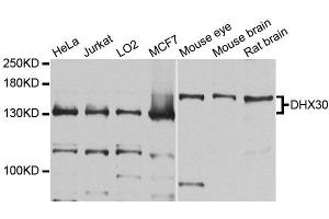 Western blot analysis of extracts of various cell lines, using DHX30 antibody (ABIN5996443) at 1/1000 dilution. (DHX30 anticorps)