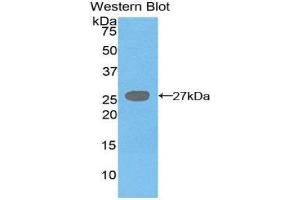 Western Blotting (WB) image for anti-Diacylglycerol O-Acyltransferase 1 (DGAT1) (AA 180-427) antibody (ABIN1858627) (DGAT1 anticorps  (AA 180-427))