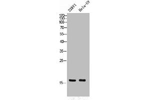 Western Blot analysis of 22RV1 HELA cells using Phospho-p16 (S326) Polyclonal Antibody (CDKN2A anticorps  (pSer326))