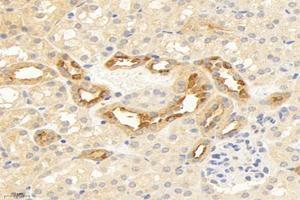 Immunohistochemistry analysis of paraffin-embedded human kidney using,TMEM213 (ABIN7075999) at dilution of 1: 2000 (TMEM213 anticorps)