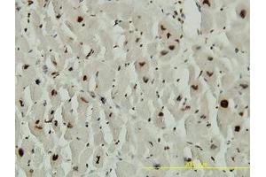 Image no. 1 for anti-Adrenocortical Dysplasia Homolog (ACD) (AA 1-545) antibody (ABIN599297) (ACD anticorps  (AA 1-545))