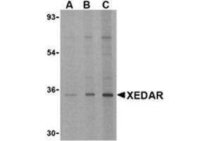 Image no. 1 for anti-Ectodysplasin A2 Receptor (EDA2R) antibody (ABIN318757) (Ectodysplasin A2 Receptor anticorps)