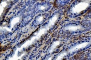 IHC analysis of U2AF65/U2AF2 using anti U2AF65/U2AF2 antibody (ABIN7600794). (U2AF2 anticorps  (AA 238-470))