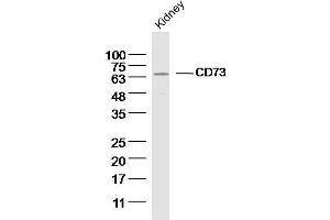 Mouse kidney lysates probed with CD73 Polyclonal Antibody, unconjugated  at 1:300 overnight at 4°C followed by a conjugated secondary antibody for 60 minutes at 37°C. (CD73 anticorps  (AA 151-250))
