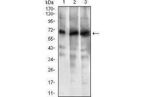 Western blot analysis using ABCG5 mouse mAb against HL7702 (1), RAJI (2) and Jurkat (3) cell lysate. (ABCG5 anticorps  (AA 306-367))