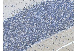 IHC analysis of LSM7 using anti-LSM7 antibody (ABIN7598937). (LSM7 anticorps  (AA 1-103))