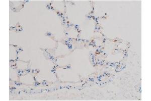 ABIN6267470 at 1/200 staining Rat lung tissue sections by IHC-P.
