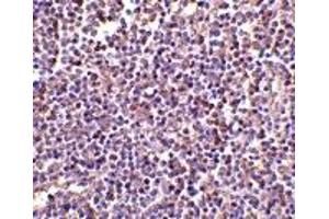 Immunohistochemistry (IHC) image for anti-AIM (N-Term) antibody (ABIN1031223) (AIM (N-Term) anticorps)