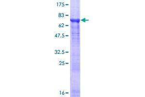 Image no. 1 for Tubulin, alpha 8 (TUBA8) (AA 1-449) protein (GST tag) (ABIN1324118)